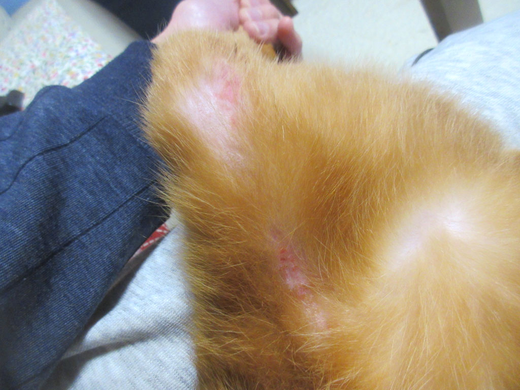 下腹部の皮膚炎。